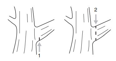 Ronix-8651-20-V-Cordless-Brushless-Chainsaw-Fig-11