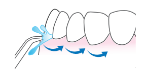 Waterpik-WF-10-Cordless-Select-Water-Flosser
