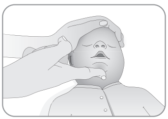 Illustration of giving backslaps to a baby in emergency care