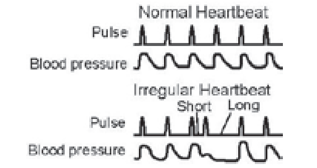 Ozeri-BP2M-Blood-Pressure-Monitor-figure-11